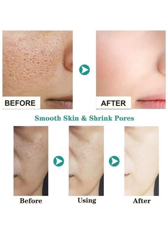 أوكويست حمض الساليسيليك حب الشباب كريم الوجه تبييض الوجه علاج حمض الهيالورونيك النقاط السوداء إزالة العناية بالبشرة الجمال الصحة إصلاح البشرة قاعدة جوهر 15 مل - Image 3